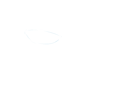 コンタクトレンズ処方